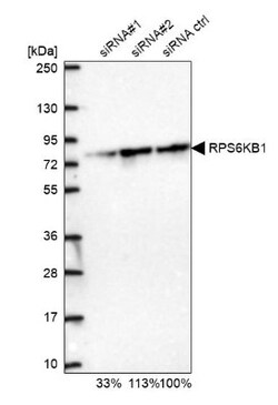 p70 S6 Kinase/S6K Antibody, Novus Biologicals 0.1mL; Unlabeled:Antibodies,